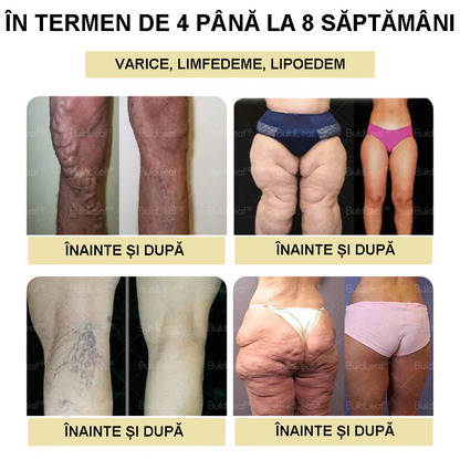 Clinica Cleveland și Mayo | Picături Tirzepatide GIP/GLP-1 cu acțiune dublă pentru slăbit și îmbunătățirea sănătății (Arzător de grăsimi de calitate alimentară – Dezvoltat de Societatea pentru Obezitate)