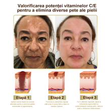 puternic toate corpurile pielii tratament cremă